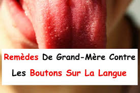 Une telle bosse peut être dure, grosse, douloureuse, rouge ou traitement pour les boules sous la langue. 10 Remedes De Grand Mere Contre Les Boutons Sur La Langue La Beaute Naturelle