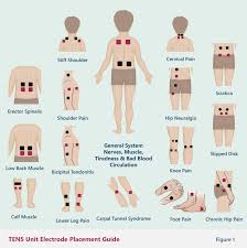 Electrode Placement Chart For Tens Unit Www