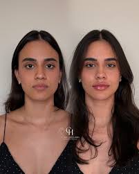 Dra. Camila Hecksher