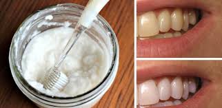 Se realizeaza consultia intiala se evalueaza dinti si. Bicarbonat Cu Lamaie Pentru Dinti Lumea Fericirii