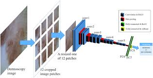 It is composed of two main blocks. Schematic Overview Of Our Cnn Architecture The Number Of Output Download Scientific Diagram