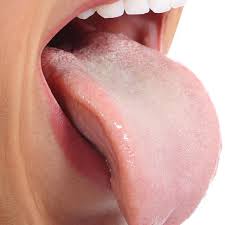 Jika gejala ini sudah terjadi plus terdapat bintik merah nah, pada artikel kali ini kami akan menjelaskan tentang cara menghilangkan panas dalam di bibir dengan cepat dan aman. 7 Cara Mengatasi Lidah Melepuh Akibat Makanan Panas Gunakan Bahan Alami Hot Liputan6 Com