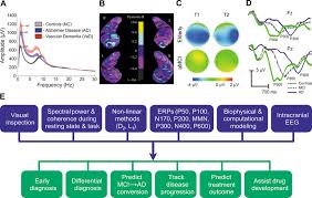 Examples Of Promising Eeg Erp Findings In Ad Research And A