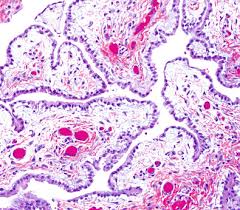 Mucosa, submucosa, muscularis externa, and adventitia. Malignant And Borderline Mesothelial Tumors Of The Pleura Sciencedirect