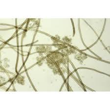 Image result for Botrytis cinerea