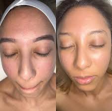 Exploring Life & Business with Amanda & Percy Bland of Modern Skin Med Spa 