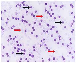 Image result for Copper Poisoning