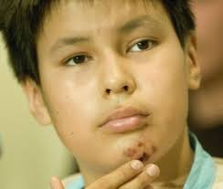 15 Year-old Lance Crowe Wounded Shooting Editorial Stock Photo