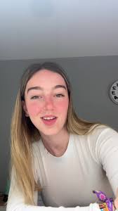 Las ronchas en el cuello por alergia: causas y soluciones