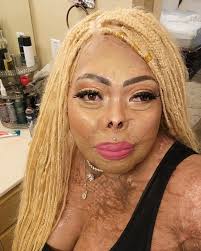 My husband accidentally set me