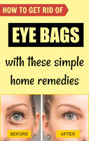 3 Best Home Remedies To Treat Under Eye Bags At Home Eyebags Homeremedies Skincare Darkcircles Flawlessskin Eye Bags Under Eye Bags Undereye