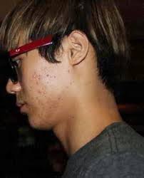 Mira Las Mejores Y Peores Pieles De Los Idols Kpop Quienes Tienen Acne Y Se Tapan Con La Bb Cream Descubrelo Aqui Generacion Kpop Noticias K Pop En Espanol