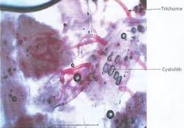 Image result for Fadogia cienkowskii