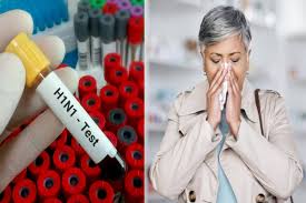 Why are elderly people at higher risk of H1N1 influenza complications, expert explains