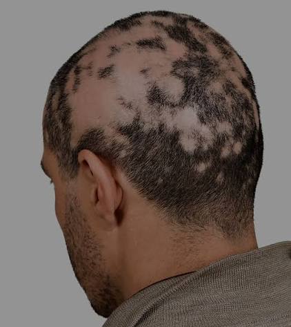 HAIR SHOCK LOSS | American Mane