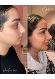 Total Wrapture Medi Spa Winnipeg