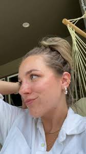 Is this what they mean by #invisalignsmile ???