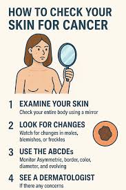 Image result for Self Skin Exam