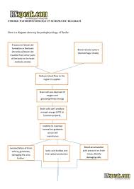 Image result for Stroke Pathophysiology