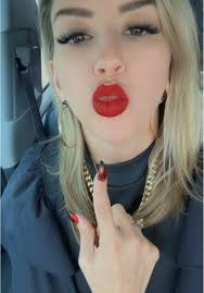 Adult braces coming off! #adultbraces #vlog #fyp #orthodontist