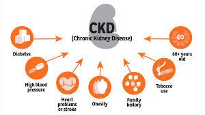 It is irreversible and generally appears over a period of years. What Is Kidney Disease