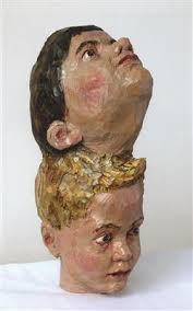 Karin Frank, Craniopagus