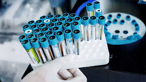 Image result for Hypermagnesemia