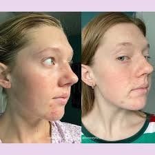 Honesty For Your Skin added a new...