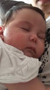 What do you use for baby rash?