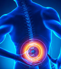 Disk herniation and gout, sciatica and spinal stenosis, osteoporosis illness set. Lumbar Spinal Stenosis Symptoms Diagnosis And Treatments