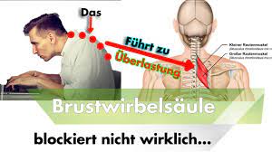 Warum Ein Rundrucken Zu Schmerzen Zwischen Den Schulterblattern Fuhren Kann Youtube