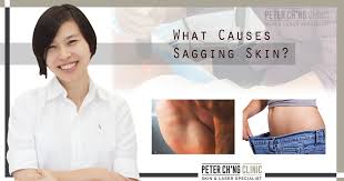 Dieting can cause you to lose weight in your upper body without changing the areas affected by lipedema.symptoms of lipedema include: What Actually Causes Your Flabby Arms Peter Ch Ng Skin Specialist Kl Malaysia