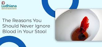Image result for Blood in stool