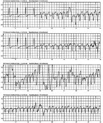 2024 Midwest Clinical & Translational Research Meeting Abstract Supplement,  2024