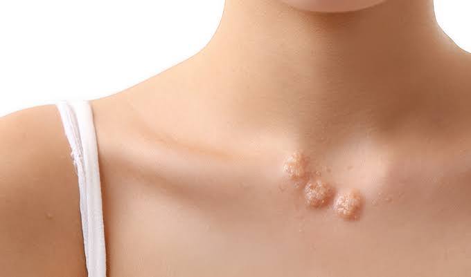 When to Worry About a Lump Under the Skin: Critical Warning Signs and  Action Steps - Craft Body Scan