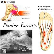 Pin On Plantar Fasciitis