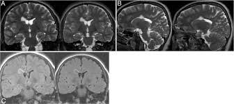 Image result for Incidental Imaging Finding