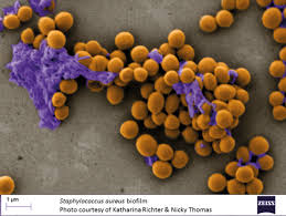 Image result for Staphylococcus Aureus