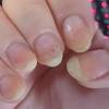 I found a dark spot under my big toenail and i was wondering if there was a way to find out what it could be. 1