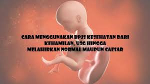 Cara bersalin paling mudah dan seronok! Cara Cek Kehamilan Usg Dengan Bpjs Kesehatan Hingga Melahirkan Normal Dan Caesar Tribun Sumsel