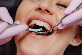 How Does General Dentistry Contribute to Your Overall Well-Being