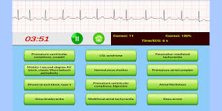 Maybe you would like to learn more about one of these? Ecg Rhythm Quiz For Android Apk Download