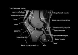 The muscles of the knee include the quadriceps, hamstrings, and the muscles of the calf. Mri Knee Anatomy Knee Sagittal Anatomy Free Cross Sectional Anatomy