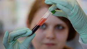 Down Syndrom Trisomie 21 Krankenkasse Zahlt Umstrittenen Bluttest Wissen