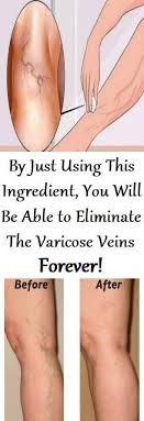 Pin On Health Beauty