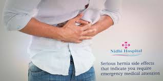 Pre And Post Care Tips For Recovery After Hernia Surgery Health And Fitness Articles Laparoscopic Surgery Surgery