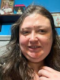 Living with bipolar disorder diagnosis