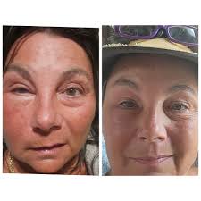 I'll take my crow's feet wrinkles any day over getting stung... bit... by a  wasp...I thank God I'm not allergic!!! I was just minding my own business  (on my day off) floating