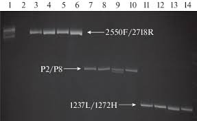 Descargar sawasu / sierras sierras cartoon la tala de.… read more łks łódź / raków_częstochowa_łks_łódź_pko_ekstraklasa_6 | łks łódź. Analysis Of Chd Gene Polymorphism As A Model Object For Molecular Sexing Of Eurasian Eagle Owl Bubo Bubo Springerlink
