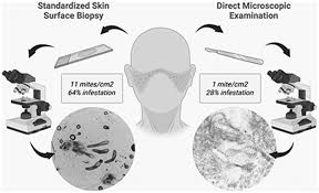 Image result for Demodex brevis